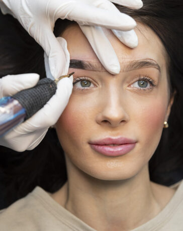 îndepărtarea tatuajelor cu laser