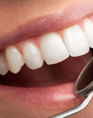 Zâmbetul Perfect Inovații Stomatologice care Redefinesc Estetica Dentară